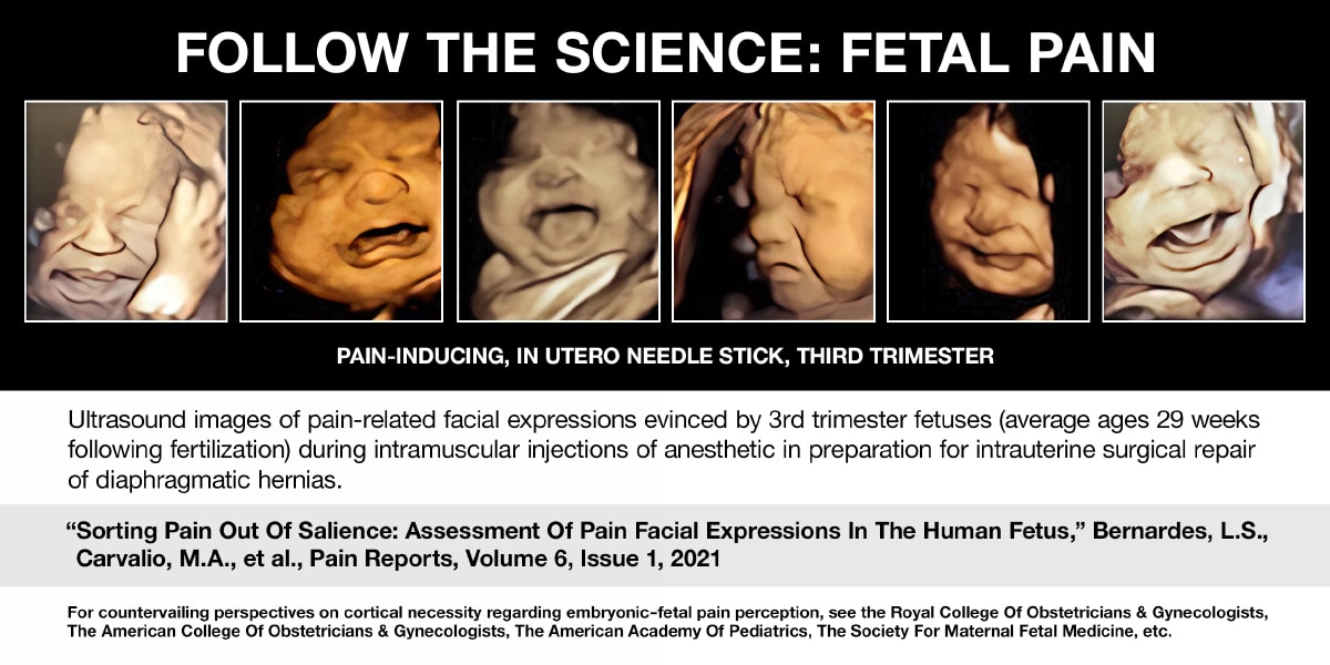 Fetal Pain 4